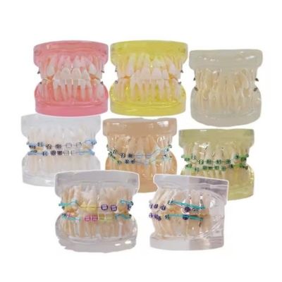 अध्ययन के लिए बहु रंग मानव दांत मॉडल ब्रैकेट के साथ दंत Orthodontic दांत मॉडल