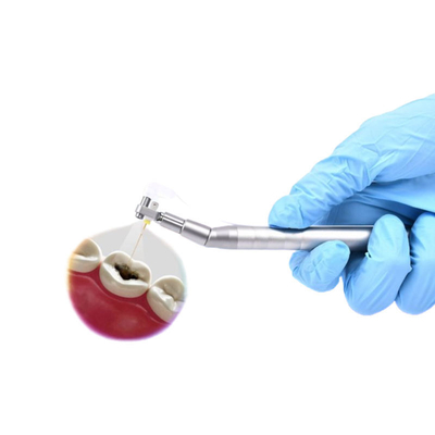 मूल नहर उपचार के लिए दृश्य डिजिटल दंत माइक्रो कैमरा इंट्राओरल एंडोस्कोप